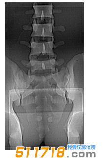 1535016002176928.png 美國(guó)CIRS 034腰椎穿刺訓(xùn)練模體1.png